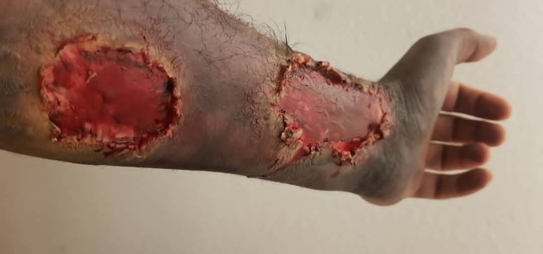 Unterarm mit künstlichen Wundeffekten aus Make-up